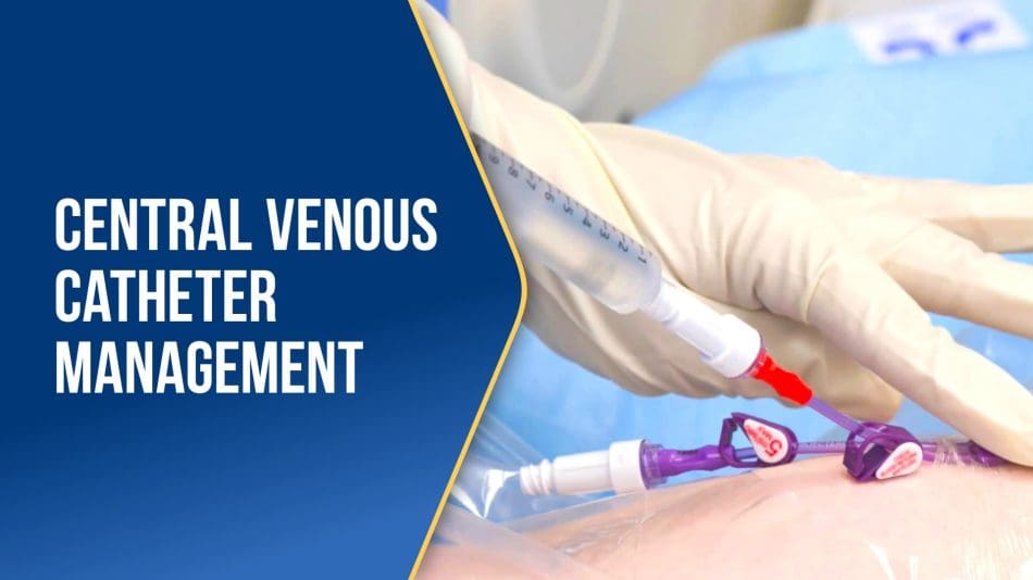 Central-Venous-Catheter-Management-01-28
